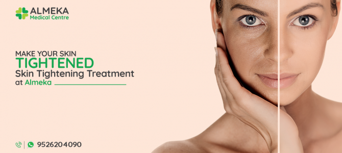 MAKE YOUR SKIN TIGHTENED. GET OUR RF TREATMENT!