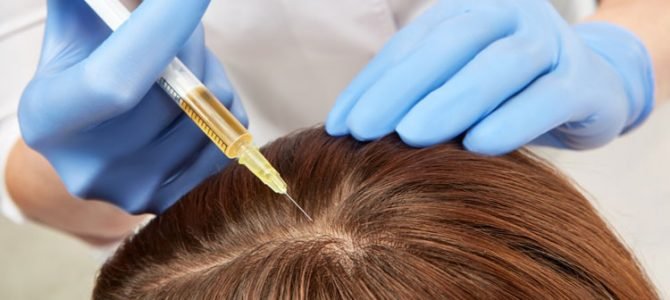 Nanofat for hair restoration – The latest in regenerative medicine
