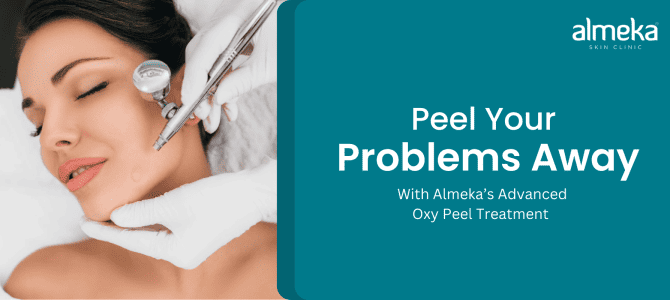 <strong>Let the Oxy Peel Treatment, calm your worries</strong>