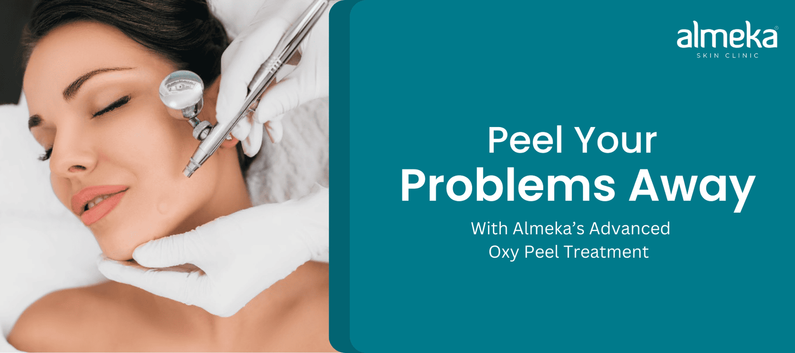 Let the Oxy Peel Treatment, calm your worries