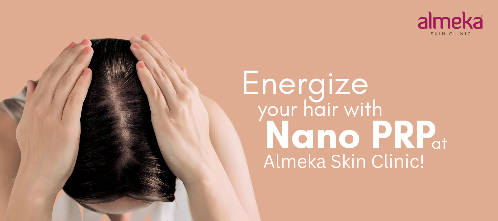 Hair Restoration with Nano PRP at Almeka Skin Clinic