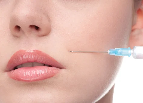 Dermal Fillers