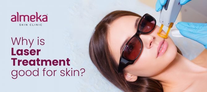 Why Laser Treatment is Good for Your Skin: Benefits & Care Tips