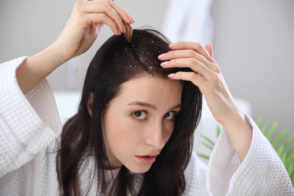 anti-dandruff treatment in Kochi