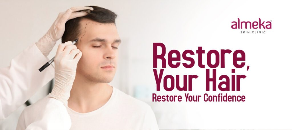 Best Hair Transplant In Kochi