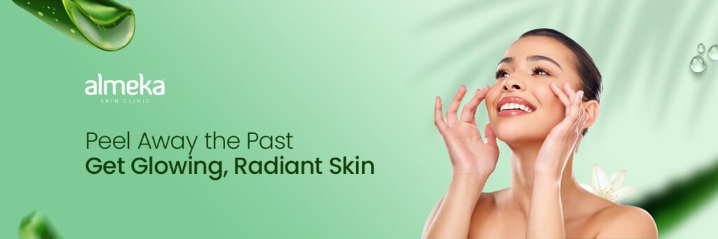 chemical peeling treatments