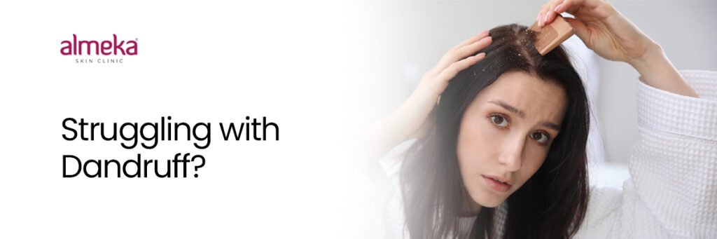 dandruff treatment in Kochi