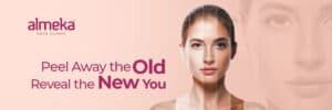 Skin Peeling Treatment in Kerala