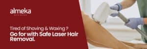 Laser Treatment for Hair Removal
